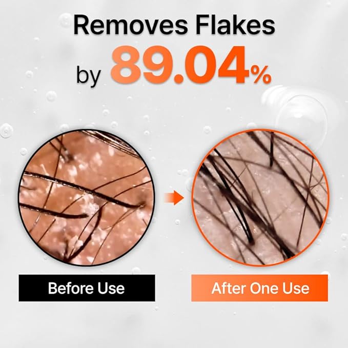 lilyeve GROWTURN Hair Growth Serum with Built-in Brush, Heartleaf-Derived Exosomes to Revitalize Hair, Hair Thickening, Hair Growth Accelerator - Korean Hair Care, 3.38 fl. oz. (Pack of 2)