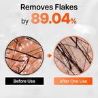 lilyeve GROWTURN Hair Growth Serum with Built-in Brush, Heartleaf-Derived Exosomes to Revitalize Hair, Hair Thickening, Hair Growth Accelerator - Korean Hair Care, 3.38 fl. oz. (Pack of 2)