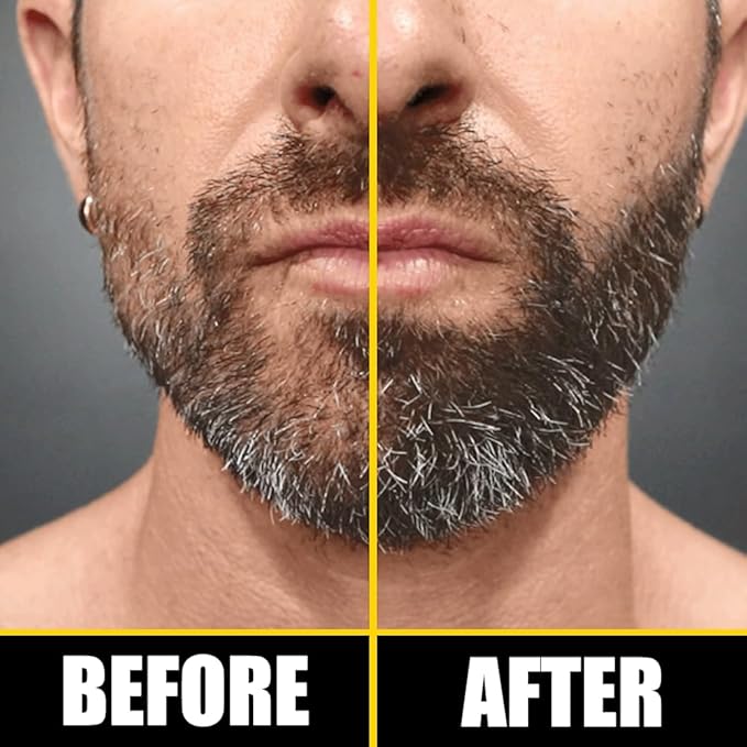 Pete & Pedro BOOST Hair & Beard Strengthening & Growth Natural Scalp Health Serum Oil For Men & Women - With Rosemary, Biotin & 20 plus Essential Oils | Shark Tank Featured, 2 oz.