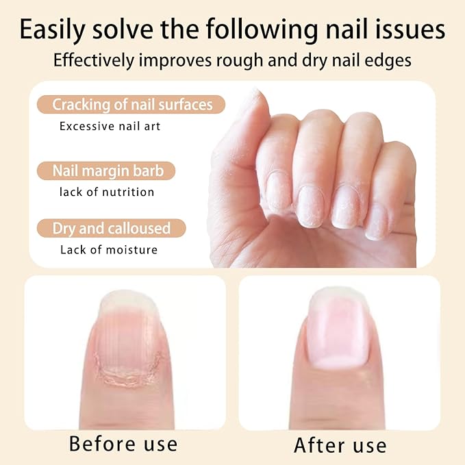 2Pcs Nail Cuticle Oils Nutrition Oil Pen Nourishment Pens 2 Smell Cuticle Revitalizer for Agnail Nourish Skin Nails Care (Apple&Grap)