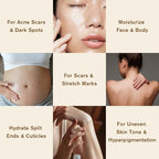 Stretch Mark Oil for Pregnancy & Body Oil for Pregnant Women, Morocco Nut Oil Help for Scars & Stretch Marks Removal & Prevention, Belly Cream for Repair, Firming & Smoothing Fine Lines (1Pack/50ml)