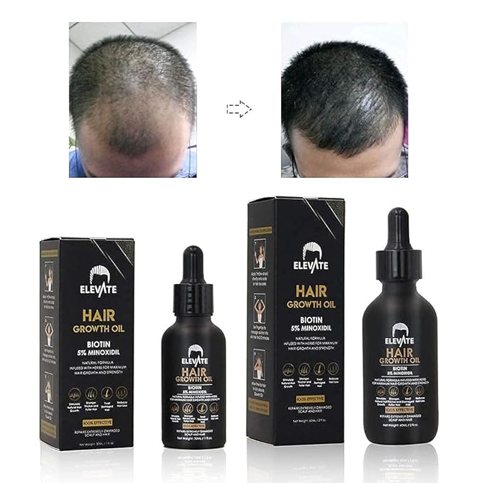 Elevate Hair Regrowth Treatment 5% Minoxidil Solution - Biotin Serum Hair Growth Oil for Men & Women - Thicker Fuller Stronger Hair - Stops Hair Loss & Thinning - Natural Hair Thickening Treatment 1oz