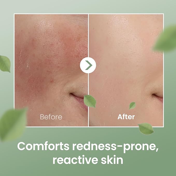 The Skin House Plum & Panthenol Calming Ampoule – Hydrating & Soothing Serum for Sensitive Skin, Non-Irritating (Dermatologist Tested) with Niacinamide & Centella[ 50ml /1.69 fl.oz]