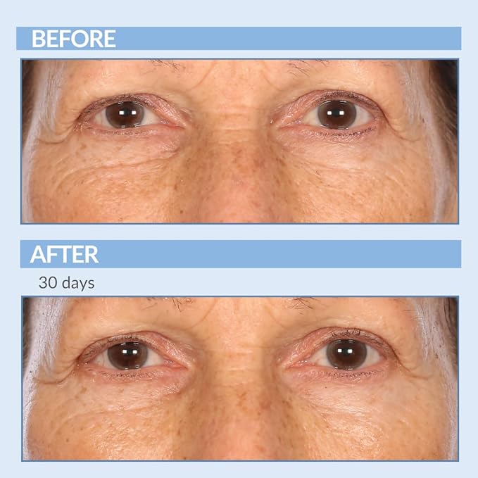 Retinol Anti-Aging Skin Care Set - Serum, Facial Moisture Cream & Face Wash - Smooth Fine Lines, Deep Wrinkles and Minimize Pores - Serious Skincare - 3 Piece Kit