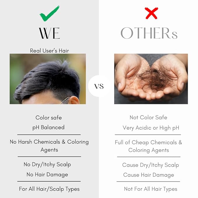 K C Scalp Detox & Hair Treatment Mask - Deep Conditioner for Dry Scalp & Damaged Hair – Scalp Care for Buildup, Flakes & Oil Control – All Hair/Scalp Types – Spa Grade Formula (FRESH)