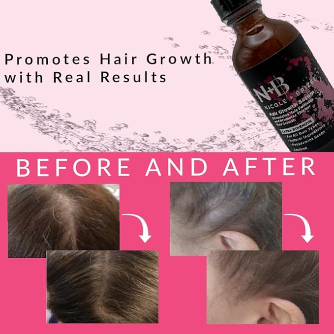 N+B Hair Growth Serum - Helps Promote Thicker, Fuller, & Healthier Hair w/Biotin, Natural-Based Formula, Helps Prevent Hair Fall & Thinning, For Women In All Hair Types - (2oz.) (6-Pack)