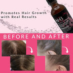 Natural Hair Growth Serum with Biotin, AnaGain, Baicapil, Peppermint Oil