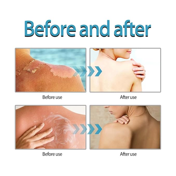 2 Pcs Centella Sunscreen, Light & Hydrating Centella SPF50 Water-Fit Sun Serum for All Skin Type and UV Defense.