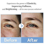 Purederm Revitalizing Eye Gel Serum – Cooling Eye Roller with 5% Volufiline, Caffeine & Vegan Collagen – Reduce Puffiness, Fine Lines & Dark Circles – For All Skin Types – 0.88 oz