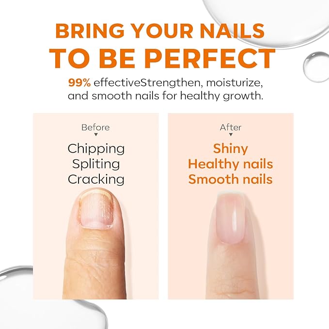 modelones Nail Strengthener Clear Nail Polish strengthener and growth Nail Repair for Damaged Nails Hardener Extra Strong and Growth Natural Nail Care Gifts for Women Concealer Polsih 15ml