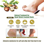 Epielle Hydrating Hand & Foot Masks, Relieve and Soften for Dry, Overworked Skin, Self Care Gifts for Women, Spa Kit, Stocking Stuffers, 6 Moisturizing Gloves & 6 Moisturizing Socks