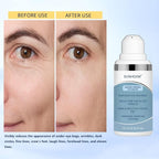 Instant Firming Eye Serum– Instantly Visibly Reduces Under Eye Bags And Wrinkles, Fine Lines, Crow's Feet, Dark Circles – Pump – Anti Aging Wrinkle Remover for Face, 10ml/0.34 Oz (2)