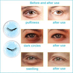 Cold Face Eye Masks Ice Face Mask Hot Cold Compress For Dark Circles, Puffiness, Migraines, Headache, Stress, Redness, Cooling Face Masks For Women Man, Skin Care