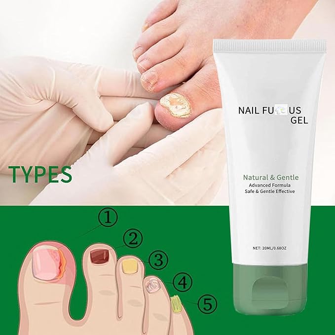 2PCS Nail Repair Gel, Nail Growth Repair Cream, Multi-Purpose Nail Repair