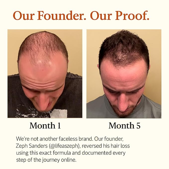 The Mane Elixir Blend: 11-in-1 Growth Oil Serum for Thinning Hair, Loss & Regrowth - 50ml