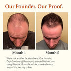 The Mane Elixir Blend: 11-in-1 Growth Oil Serum for Thinning Hair, Loss & Regrowth - 50ml