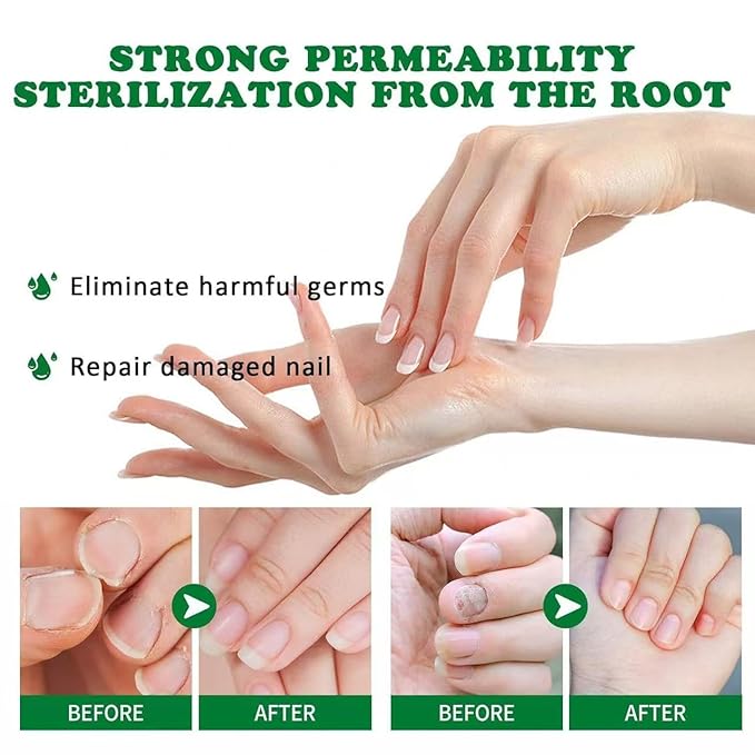 2PCS Nail Repair Gel, Nail Growth Repair Cream, Multi-Purpose Nail Repair
