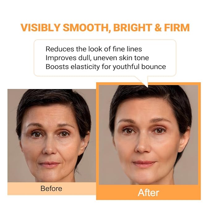 Vitamin B12 Lotion (1 oz) | Repair & Hydrating Cream for All Ages （teen & adult| Soothes Redness, After-Sun Skin Relief, Strengthens Barrier, Sensitive Skin Safe