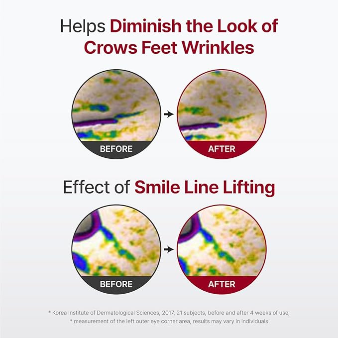 CENTELLIAN 24 Madeca Derma Face Mask (Intensive, 10pc) - Soothing Cotton Sheet Mask for Sensitive, All Skin Types, 24-Hour Hydration. Premium Korean Skin Care. TECA, Centella Asiatica, Madecassoside