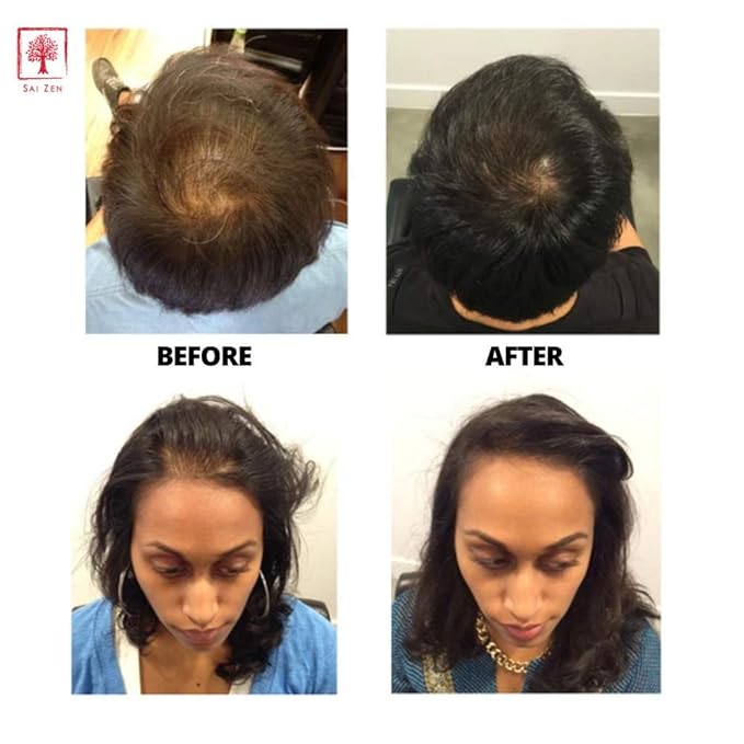 Volume Plus Set | Volumizing Shampoo 8 oz. & Scalp Therapy Spray 4 oz. | Anti-Thinning Formula | Made in USA | Sulfate, Alcohol & Paraben Free