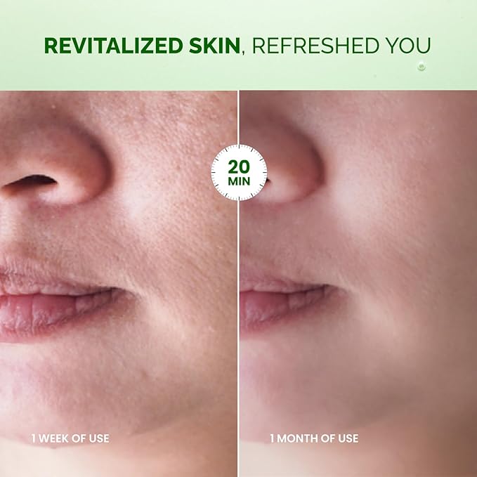 PLANTIFIQUE Superfood Facial Sheet Mask Variety Box 5 Pack – Face Mask Set with Coconut, Aloe, Vitamin C, Centella & Collagen – Hydrating & Refreshing – For All Skin Types