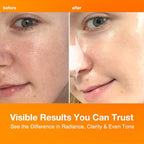 NIGHTINGALE C-TONING VITAMIN C SERUM For Face,Anti Aging and Skin Brightening with Vitamin C,Niacinamide, Hyaluronic Acid,Vitamin E,Adenosine,Reduces dark Spots, uneven skin Tone, 1.69fl.oz(50ml)