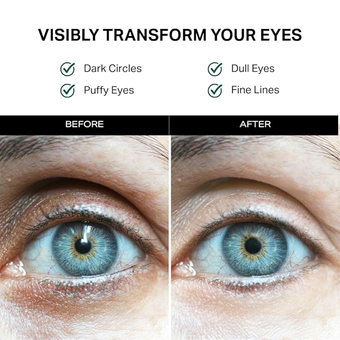 Y’OUR Retinol & Peptide Complex Eye Cream: Anti-Aging for Dark Circles, Puffiness, Wrinkles & Crow’s Feet; Hydrating & Under Eye Repair. Made in USA