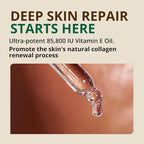 Vitamin E Oil - 100% Pure & Natural, 85,800 IU. Repair Dry, Damaged Skin from Surgery & Acne, Age Spots & Wrinkles. Boost Collagen for Moisturized, Youthful-looking Skin. d-alpha tocopherol, 2 Fl Oz