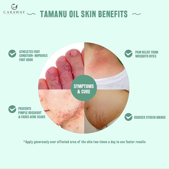 CARAWAY Tamanu Oil Organic for Skin - Cold Pressed - Natural Moisturizer for Dry Skin, Face and Hair - Helps Treat Hyperpigmentation, Acne scars, Eczema, Psoriasis- 1.7 Fl oz - 50 ml