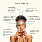 M.A.D Skincare Salicylic Cleansing Gel - Acne Facial Wash 6.75 oz.