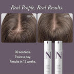 NULASTIN Solution Serum System - Lash Serum (0.1 Fl Oz), Scalp Treatment (1.7 Oz) + Brow Serum (0.1 Fl Oz) - Travel Gift Set for Fuller Lashes, Thicker Hair & Defined Brows (3 Count)