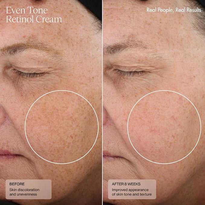 Senté Even Tone Retinol Cream | 0.5% Retinol Combined with HSA & Skin-Firming DSA | Improves Skin Tone, Texture, & Dark Spots | 1.0 Fl Oz