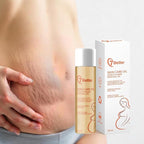 Stretch Mark Pregnancy Oil, Natural Oil Skincare Body Oil Serum for Scars and Stretch Marks, Face with Vitamin E & A for Sensitive Dry Skin and Body Moisturizer