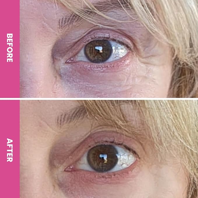 PRIME PROMETICS PrimeEyes Hydrate Under Eye Cream for Mature Women – Hydrating Eye Cream for Dark Circles and Wrinkle Repair – Soft, Glowing & Healthy Under Eyes