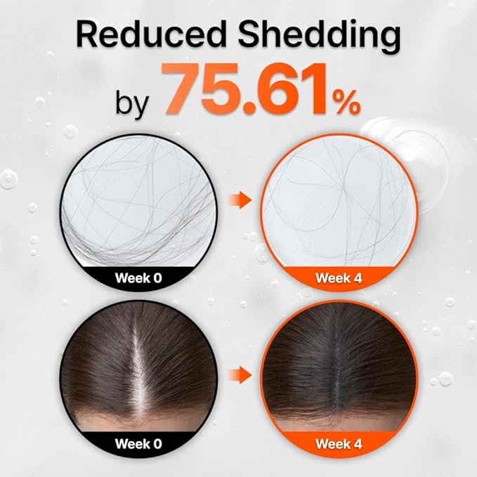 lilyeve GROWTURN Hair Growth Serum with Built-in Brush, Heartleaf-Derived Exosomes to Revitalize Hair, Hair Thickening, Hair Growth Accelerator - Korean Hair Care, 3.38 fl. oz. (Pack of 1)