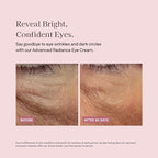 Botanic Pretti5 Advanced Radiance Eye Cream — a Fast-Absorbing Treatment that Tackles Puffiness, Dark Circles, Boosts Circulation & Smooths Fine Lines Around the Eyes