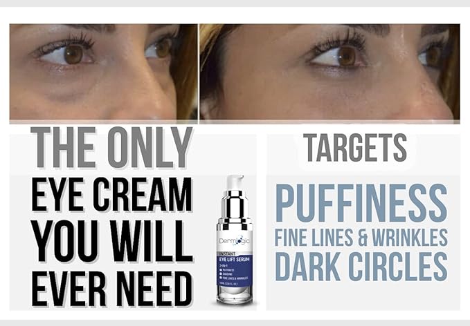 Under Eye Puffiness & Dark Circles Rapid Treatment- Instantly Reduces the Appearance of Puffy Eye Bags, Crow’s Feet, & Sagging Skin.