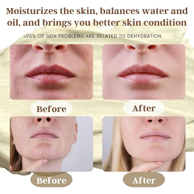 100% Grass-Fed Beef Tallow Balm, Manuka Honey MGO263+, Organic Beeswax & Olive Oil, Beef Tallow for skin,Handmade Moisturizer for Dry Skin, Eczema Relief, & Healing Skin(2oz, Vanilla)