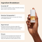 Stratia Lipid Gold Eye Cream Moisturizer and Anti-Aging Skincare for Dark Circles, Fine Lines, Wrinkles, and Under-Eye Brightening, 0.5 fl. oz