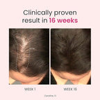 Trybello Anti-Stress & Hair Growth Gummies for Women | Sugar-Free, Vegan Hair Supplements | Gluten-Free, Soy-Free, Dairy-Free Gummy Vitamins for Thicker, Healthier Hair | 60 Servings | 2 Pack Combo