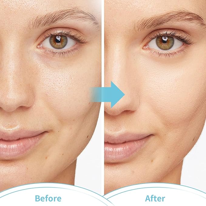 2PCS Cold Face Eye Masks Ice Face Mask Hot Cold Compress for Dark Circles, Puffiness, Migraines, Headache, Stress, Redness, Cooling Face Masks for Women Man, Skin Care