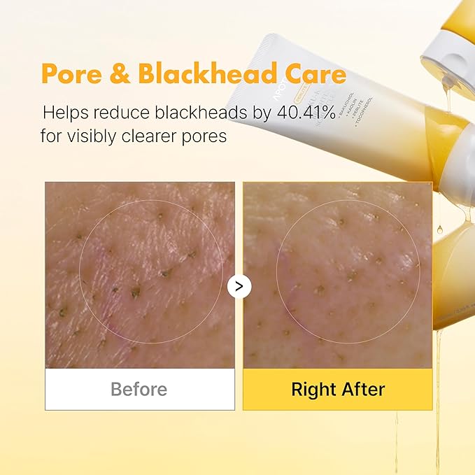 APOTHE Baku-Kaol Brightening Scrub Cleanser with Perlite, Kaolin & Bakuchiol – Gentle Exfoliating Face Wash for Radiant Skin, 3.38 fl oz (100 mL)