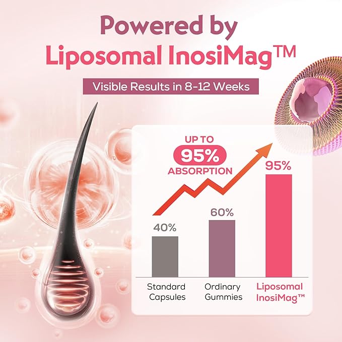 Liposomal Hair Growth Soft Chews – High Potency Hair Growth Vitamins for Women & Men with Biotin, InosiMag Complex, Collagen, Zinc - Strong Hair Skin Nails Vitamins, 120 Count