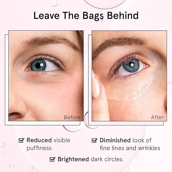 grace & stella Under Eye Brightener Roller - Airplane Travel Essentials - Travel Size Toiletries - Retinol & Caffeine Eye Serum for Puffiness, Dark Circles, Wrinkles - Vegan Skincare (15ml / 0.51floz)