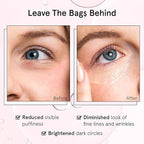 grace & stella Under Eye Brightener Roller - Airplane Travel Essentials - Travel Size Toiletries - Retinol & Caffeine Eye Serum for Puffiness, Dark Circles, Wrinkles - Vegan Skincare (15ml / 0.51floz)