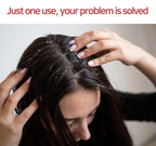 Biotin and Zinc Pyrithione Shampoo - Combats Itching, Dandruff, Seborrhoeic Dermatitis & Sebum Buildup | Scalp Care Solution | 300ml 10 oz