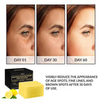 VALITIC Brightening Lemon & Turmeric Kojic Acid Soap with Vitamin C, Retinol, Collagen - Original Japanese Complex Infused with Hyaluronic Acid, Vitamin E, Shea Butter, Castile Olive Oil (3 Pack)