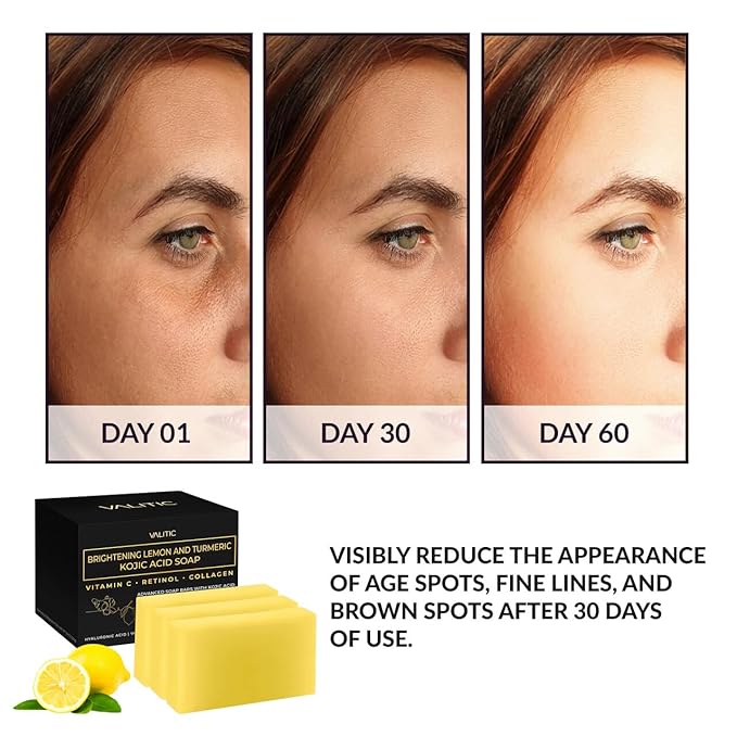 VALITIC Brightening Lemon & Turmeric Kojic Acid Soap with Vitamin C, Retinol, Collagen - Original Japanese Complex Infused with Hyaluronic Acid, Vitamin E, Shea Butter, Castile Olive Oil (3 Pack)