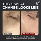 Titan MAX Anti-Aging Peptides Serum for Face – Ultra Potency Mens Peptide Serum Moisturizer – Mens Skin Care – Men, Dark Spots, Wrinkles, Fine Lines – Peptides, 10% Niacinamide, HA –Unscented