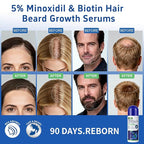 5% Minoxidil for Women& Men, Minoxidil Hair Growth Serum(Biotin-Infused) with Sponge Applicator for Thinning Hair& Receding Hairline, 8 Month Supply-6 x 2.71Fl oz